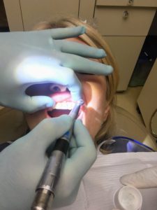 The dentists all wear "headlamps" similar to coal miners or night time mountaineers. The lights however are very concentrated and the magnifying eyeglasses give the dentists almost laser vision.