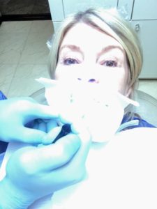 The patient- me- looks very concerned and uncomfortable- all in the quest for whiter, brighter, cleaner teeth.